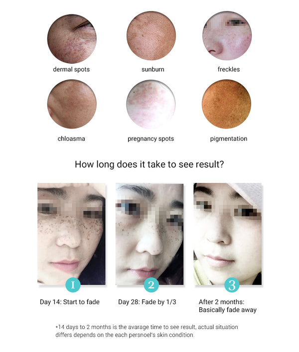 2022  CBD FRECKLE REMOVAL CREAM Facial Care